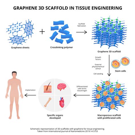  Graphen – Revolutionerande Material för Biomedicinska Implantat och Reparationsteknologier!