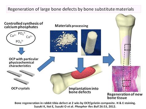 Osteoinduktiv Keramik för Benreparatur och Vävnadsregeneration!